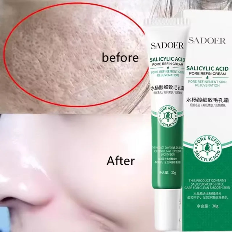 Salicylic Acid Pore Shrinking Cream Eliminate Large Pores Serum Remove Blackhead Acne Repairing Tightening Skin Care Cosmetics